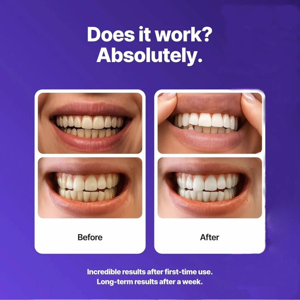 SmileLab™ Purple Power Whitening Strips