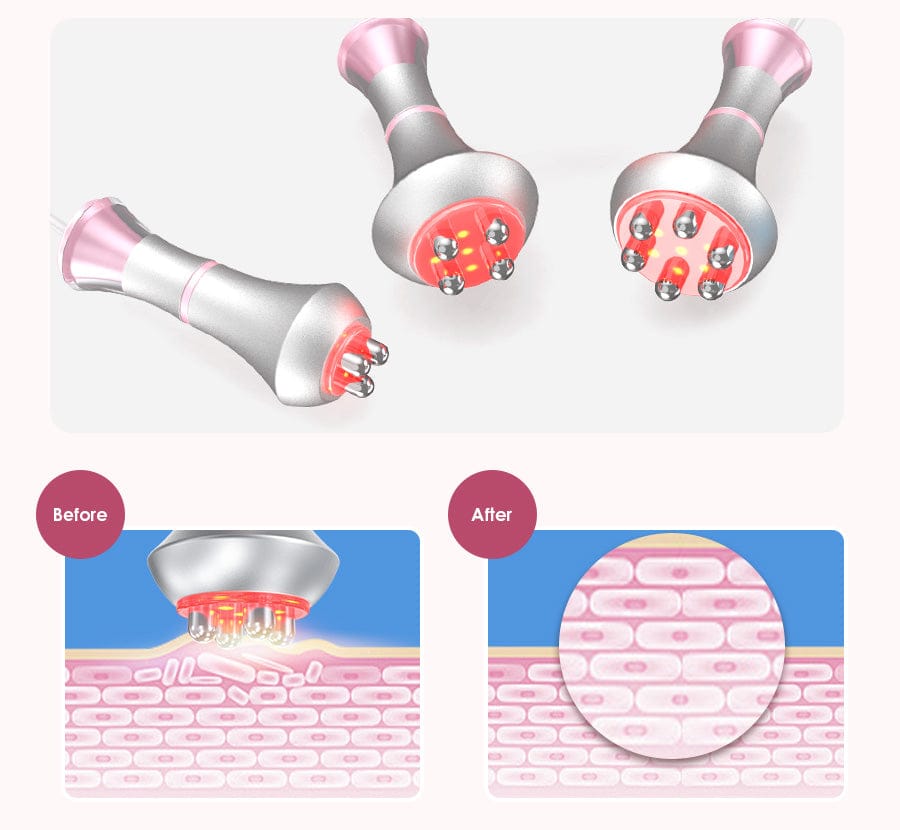 6-in-1 80K Professional Ultrasonic Cavitation Machine